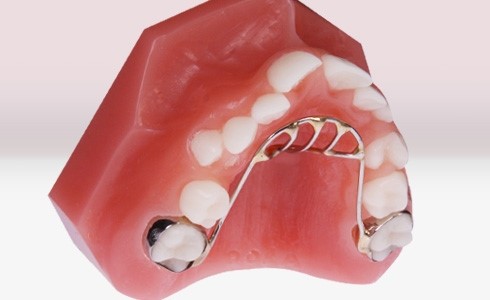 وسیع کننده قوس دندانی