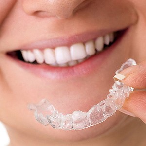 ارتودنسی و تحلیل ریشه دندان