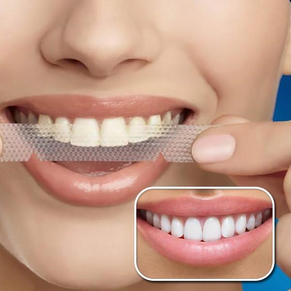  سفید نگه داشتن دندان در طول ارتودنسی