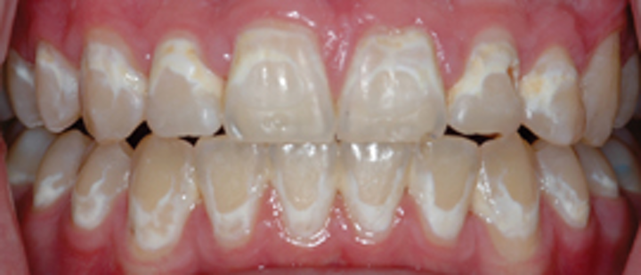 نقش دندانپزشک در درمان ارتودنسی