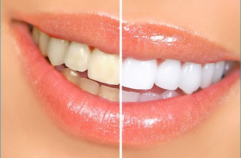 دندانپزشکی زیبایی و درمان ارتودنسی