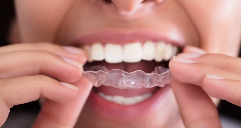 نقش دندانپزشک در درمان ارتودنسی