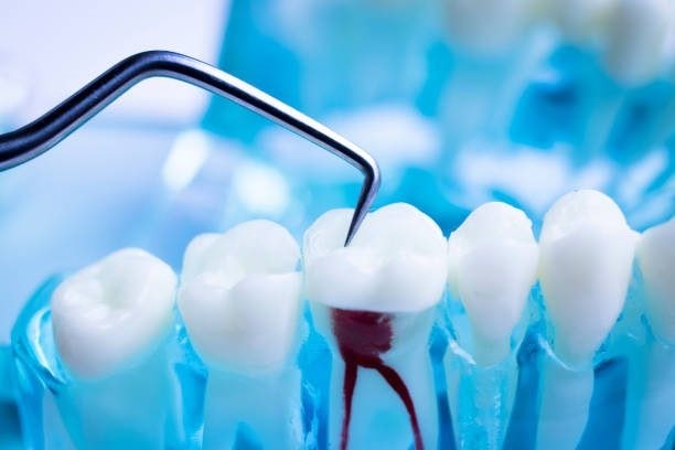معاینات منظم دندانپزشکیمعاینات منظم دندانپزشکی