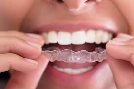 کاهش خطر پوسیدگی با تمیز کردن الاینر