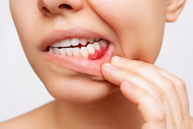 چه زمانی برای دریافت کمک تخصصی به دندانپزشک مراجعه کنیم؟