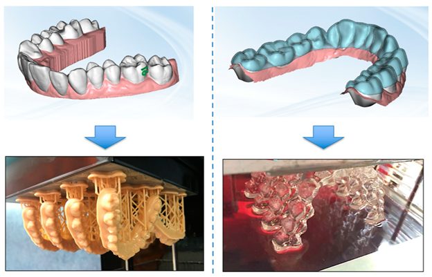 انواع فاصله هایی که الاینر شفاف می تواند برطرف کند.