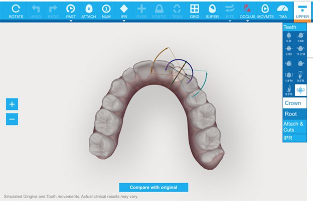 افسانه شماره ۶: الاینرها به ویزیت های منظم دندانپزشکی نیاز ندارند.